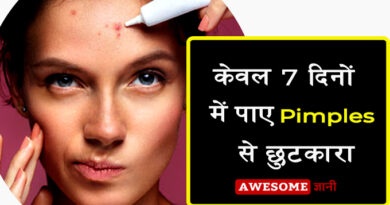 केवल 7 दिनों में पिम्पल्स (Pimples) से पाए छुटकारा, How to prevent pimples on face in hindi Get Rid of Pimples in 7 Days