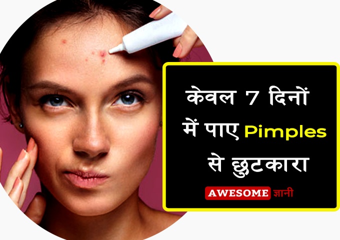 Home remedies for pimples in Hindi