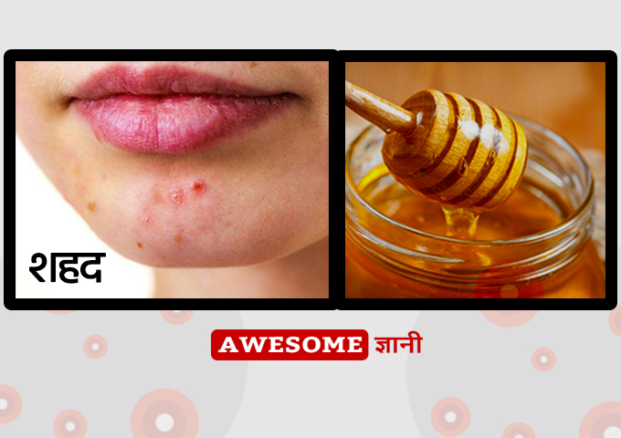 Honey - Home remedies for pimples in hindi