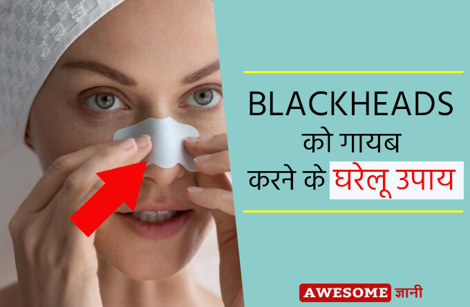Home remedies for blackheads on nose in Hindi