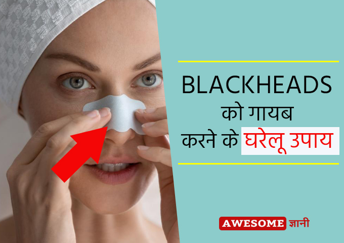 Home remedies for blackheads on nose in Hindi