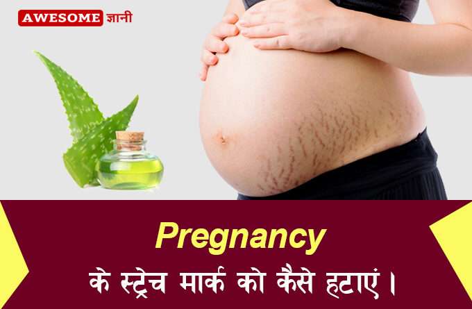 How to remove stretch marks in hindi