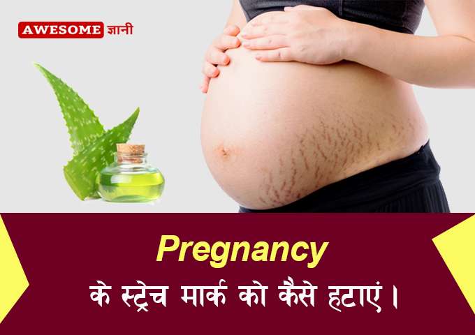 How to remove stretch marks in hindi