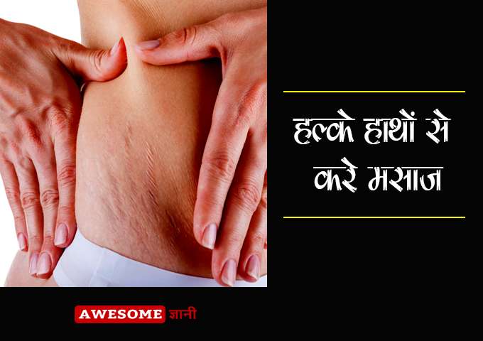Massage with light hands - How to remove pregnancy stretch marks at home in hindi